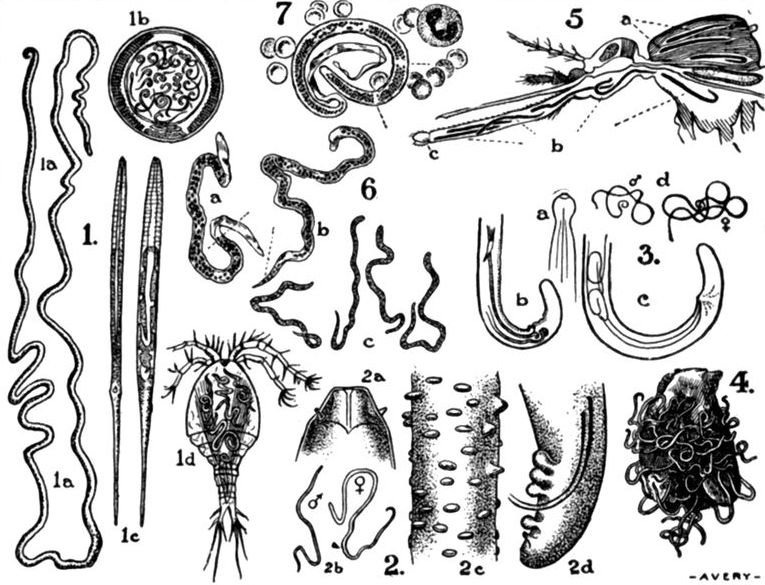 Line drawings of some filarial worms.