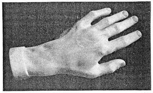 Chopin’s Hand