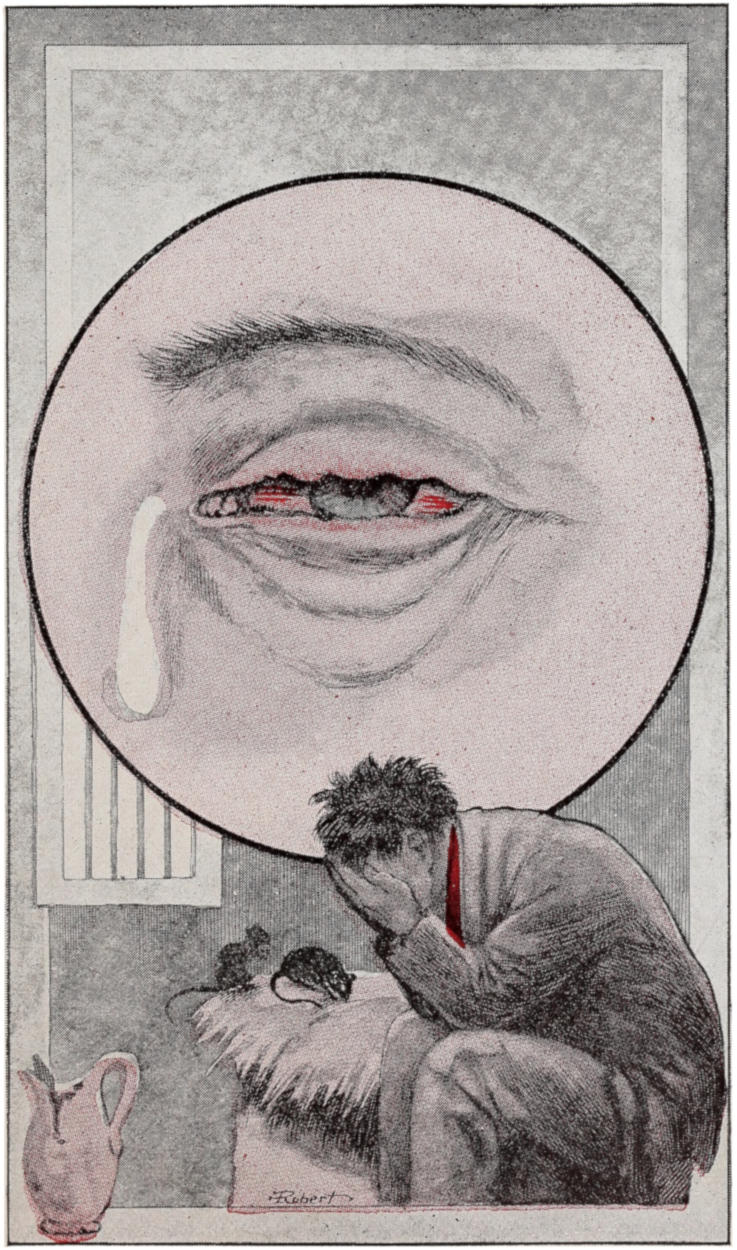 Bleary inflamed eye; man sitting on rat infested prison bunk