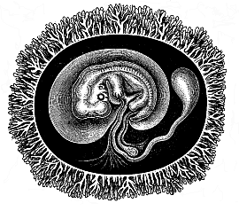 Human embryo with its membranes, six weeks old.