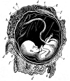 Human foetus, twelve weeks old, with its membranes.