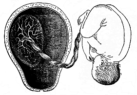 Mature human foetus (at the end of the pregnancy, in its natural position, taken out of the uterine cavity).
